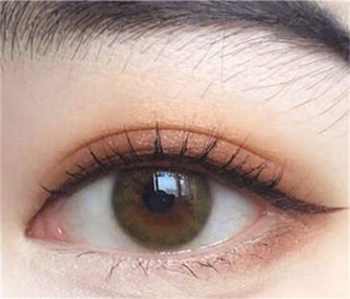 开眼角疤痕增生怎么办呀-提眉术和开眼角可以一起做吗